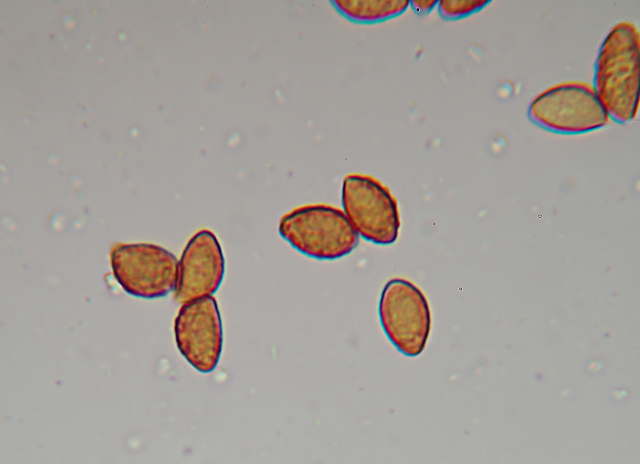 Messa a punto del microscopio
